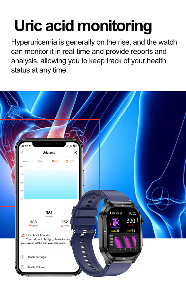 ET281 uric acid measurement